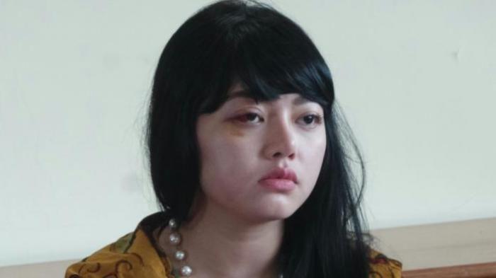 Kasus Penganiayaan Dita Vs Masinton Makin Panas, Inilah Kronologinya!
