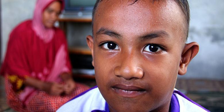 Gara-gara Kelainan Hormon, Bocah 5 Tahun Ini Sudah Jadi Seperti Orang Dewasa