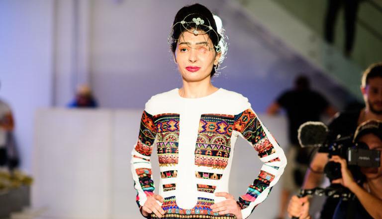 Jadi Korban Serangan Asam, Reshma Qureshi Tampil Memukau di New York Fashion Week