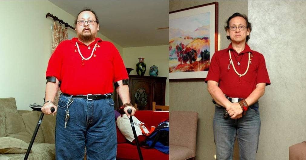 15 Tahun Tak Bisa Berjalan, Dalam 6 Bulan Pria Ini Bisa Berlari dan Sukses Turunkan Bobot 50 Kg