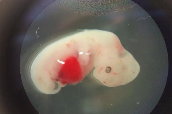 Human-Pig Hybrid: Organ Manusia Bisa Dihasilkan dari Babi