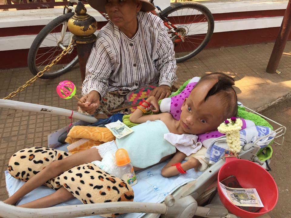 Malang, Bayi Ini Terlahir dengan Retakan di Kepala
