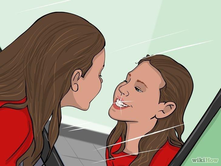 Pengalaman  Memakai Kawat Gigi, Hanya Kamu Saja Yang Tahu Bagaimana Rasanya