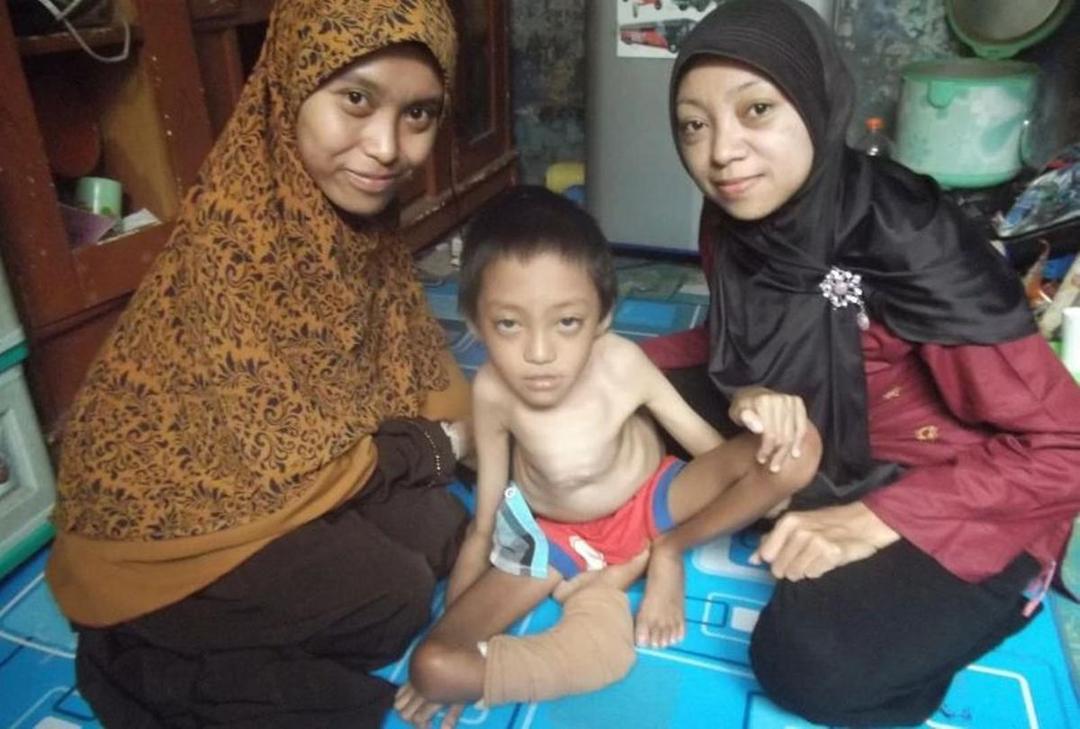 Tulang Fahri Patah Tiap Kali Batuk, Ini 8 Fakta dan Kisahnya