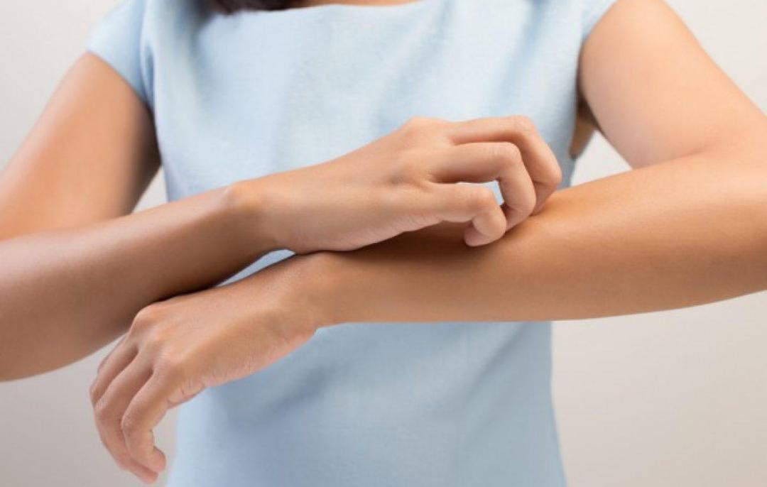 Ternyata Tatapan Mata Gak Cuma 'Menularkan' Cinta, Tapi Juga Rasa Gatal