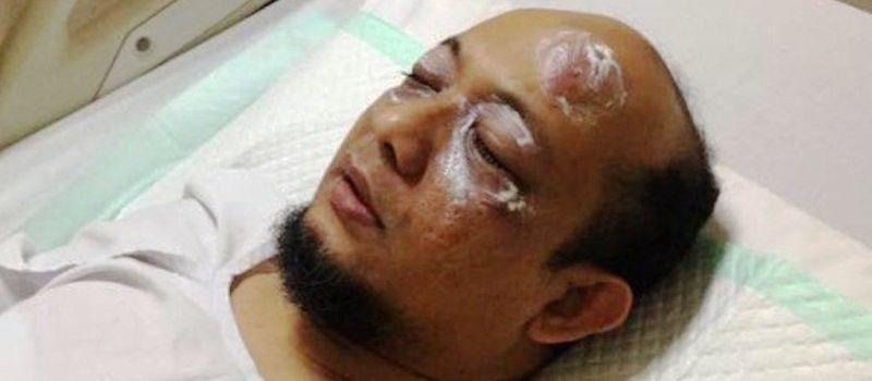 Polisi Kantongi Data Penyiram Air Keras ke Wajah Novel Baswedan, Ini Ciri-cirinya