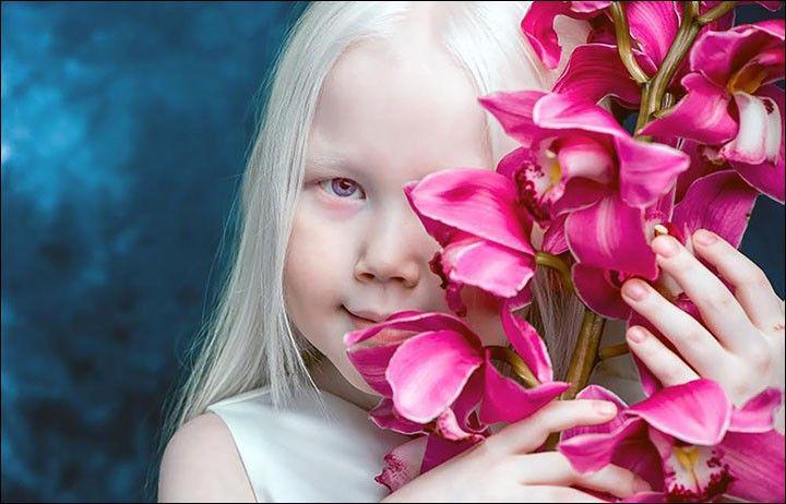 Dijuluki "Snow White" dari Siberia, Gadis Albino ini Menjadi Rebutan Fotografer Dunia