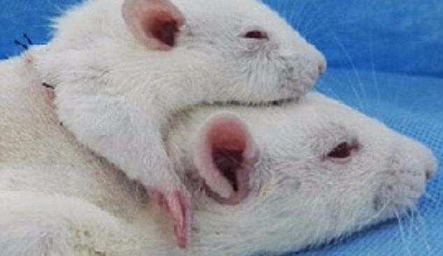 Setelah Tikus, Dokter Ini Ingin Transplantasi Kepala Manusia