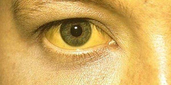 obat-hepatitis.com