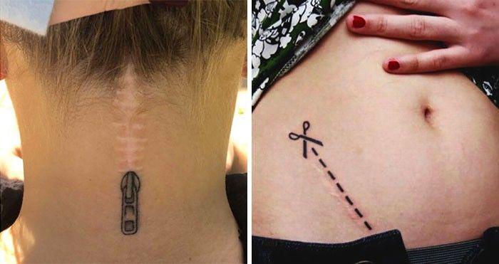 Kreatif Banget, 30 Tato ini Menyulap Bekas Luka jadi Seni Indah!
