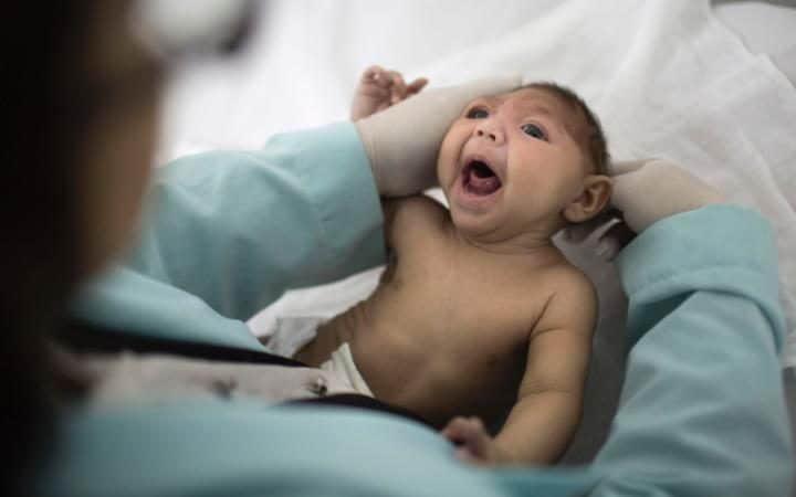 Virus Zika Disebut Bisa Bunuh Sel Tumor Otak