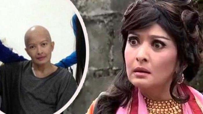 Yana Zein Meninggal Dunia Usai Lawan Kanker Payudara
