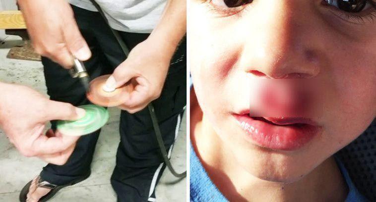 Fidget Spinner Memakan Korban, Jangan Sampai Salah Memainkannya