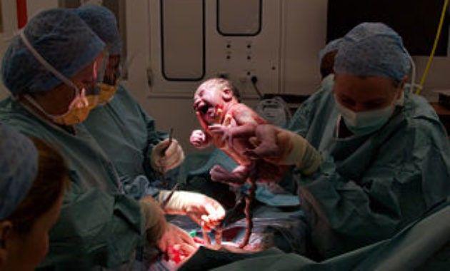 Dokter Ini Rela Keguguran Bayinya Demi Membantu Pasiennya yang Melahirkan