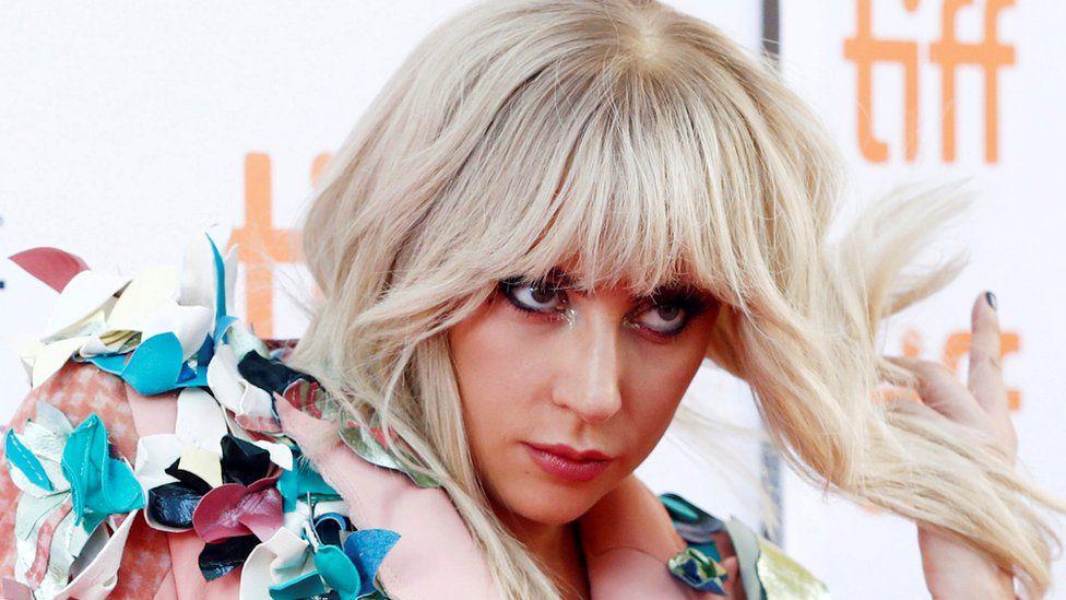 Lady Gaga Kena Penyakit Kronis, Batalkan Konser di Kanada