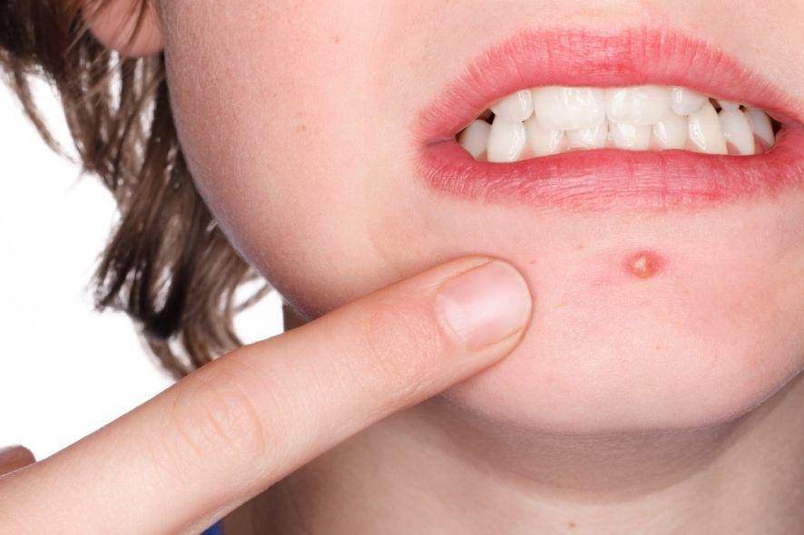 acne.com