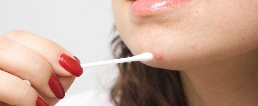 acne-advice-guide.doctorfox.co.uk