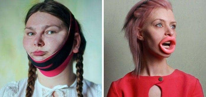 5 Alat Absurd Ini Dinilai Bisa Mempercantik Wajah, Mau Pakai?