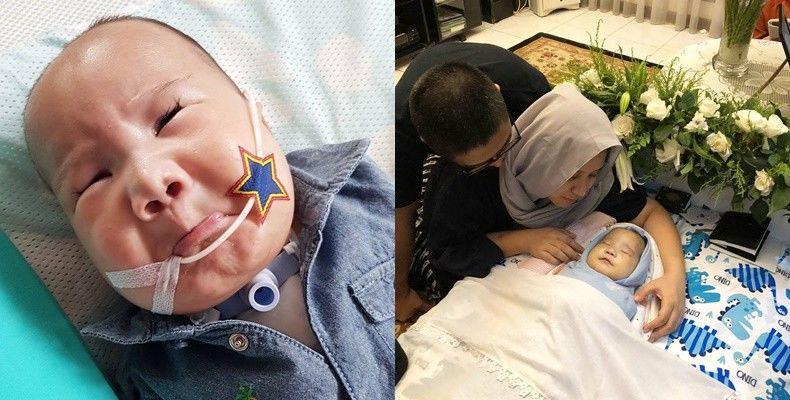 7 Bulan Lawan Trisomi 13, Baby Adam Fabumi Meninggal Dunia