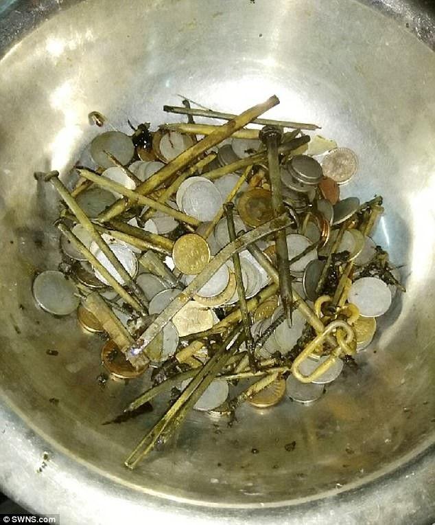 Mengerikan, 263 Koin & 100 Paku Bersarang di Perut Pria Ini