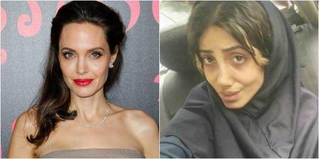 Obsesi Mirip Angelina Jolie, Cewek Ini Operasi Plastik Hingga 50 Kali