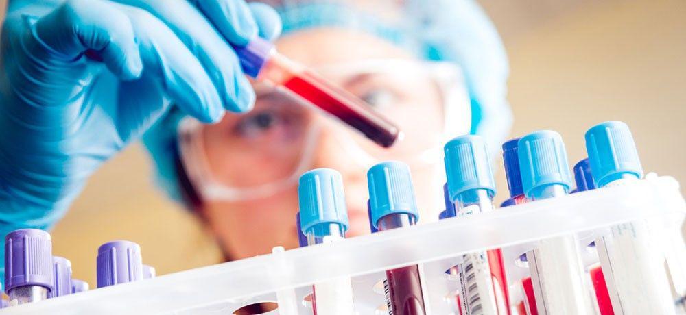 Tes Darah Ternyata Dapat Mendeteksi Protein Beracun Pada Alzheimer Lho