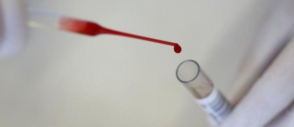 8 Kanker Dapat Terdeteksi Sekaligus Hanya Dengan Tes Darah