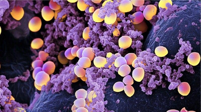ilustrasi Staphylococcus, salah satu penyebab periostitis akut (healththoroughfare.com)