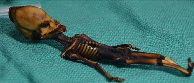 Dulu Dikira Bayi Alien, Dari Sinilah Asal Muasal Mumi di Foto Ini