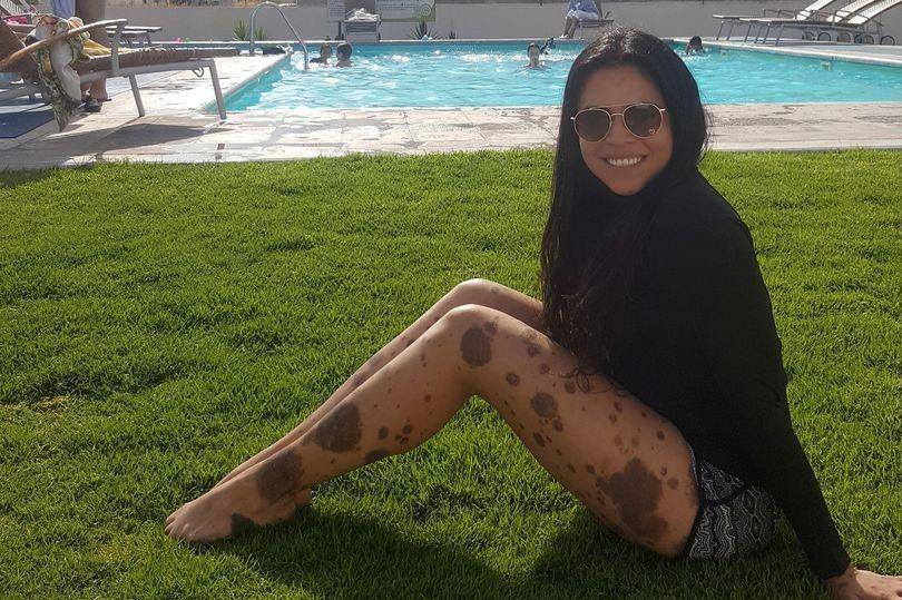 Lorena Bolanos / SWNS