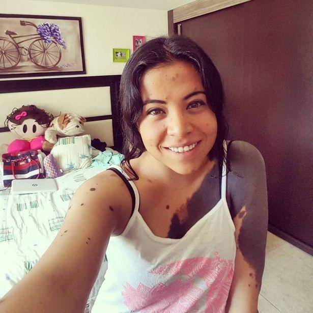 Lorena Bolanos/SWNS