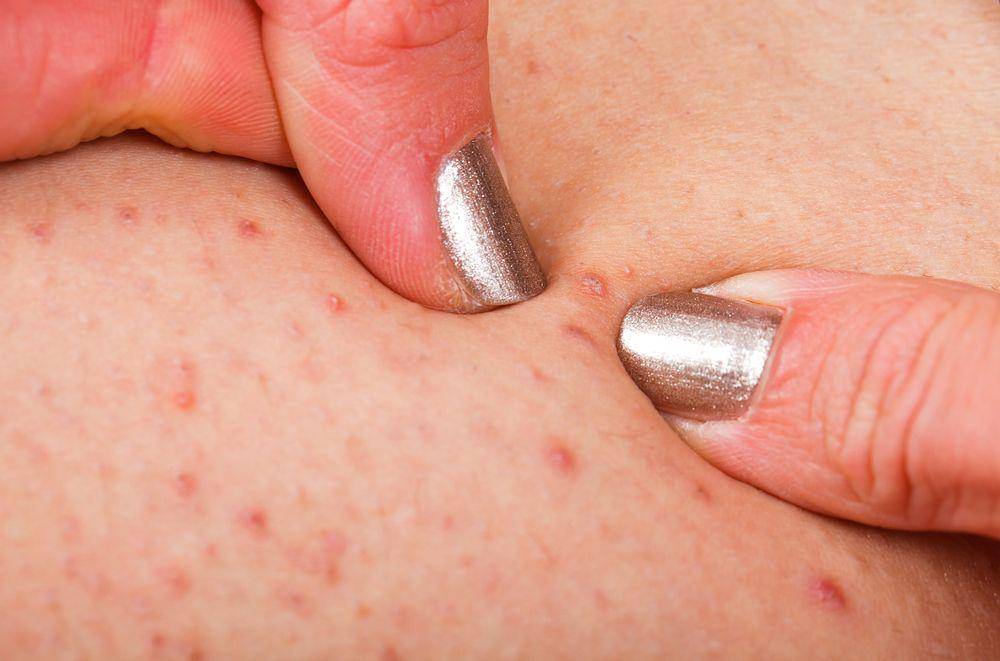 drscabies.com
