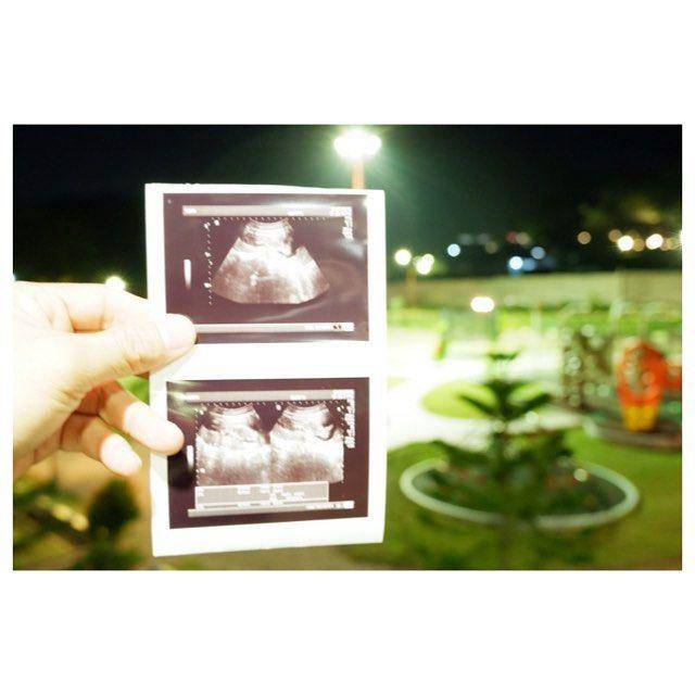 Instagram.com/arie10andika