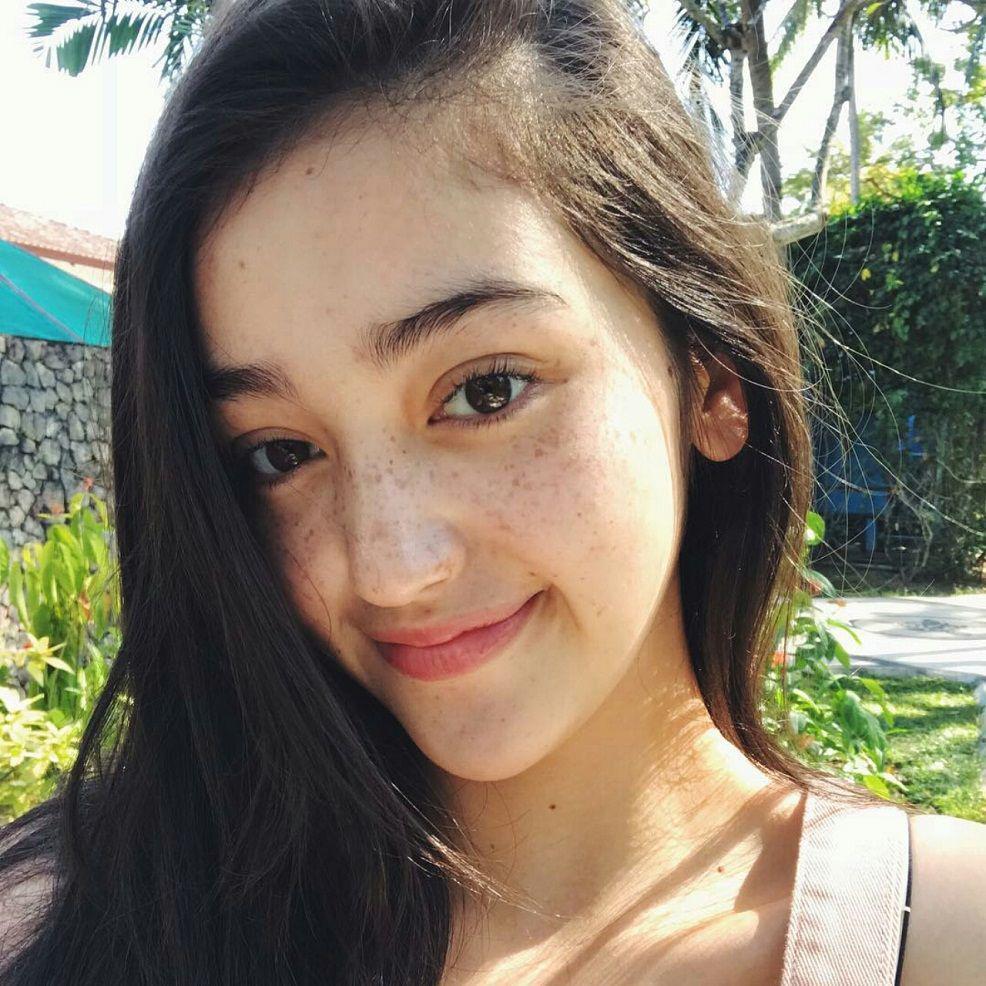 Tanpa Make-up, 7 Artis Ini Tampil Cantik dengan Freckles Alaminya