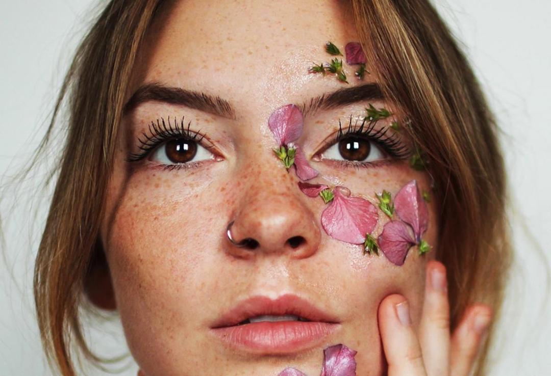 Jadi Tren Kecantikan, Ini 7 Fakta Unik tentang Freckles