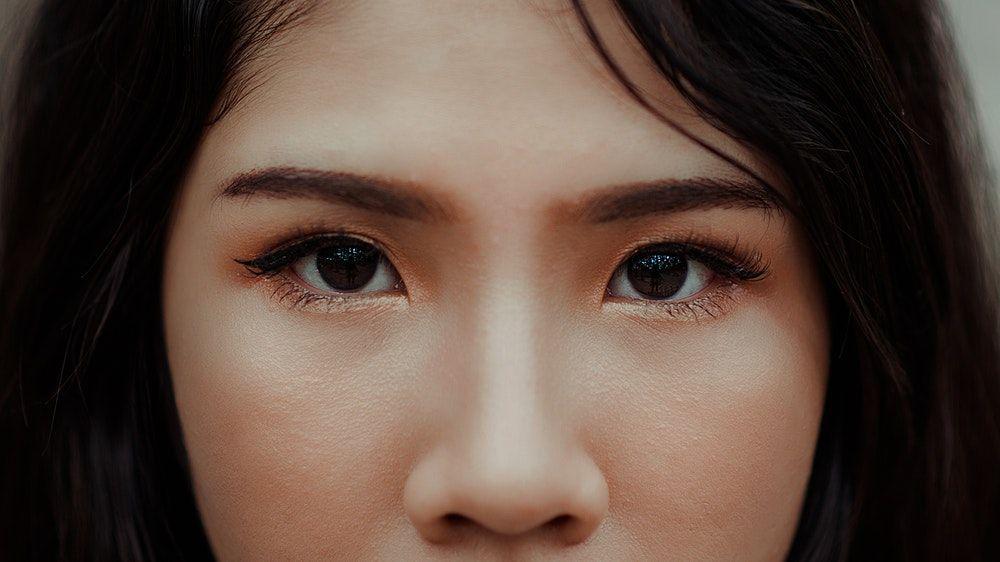 10 Cara Menghilangkan Jerawat secara Alami Tanpa Iritasi