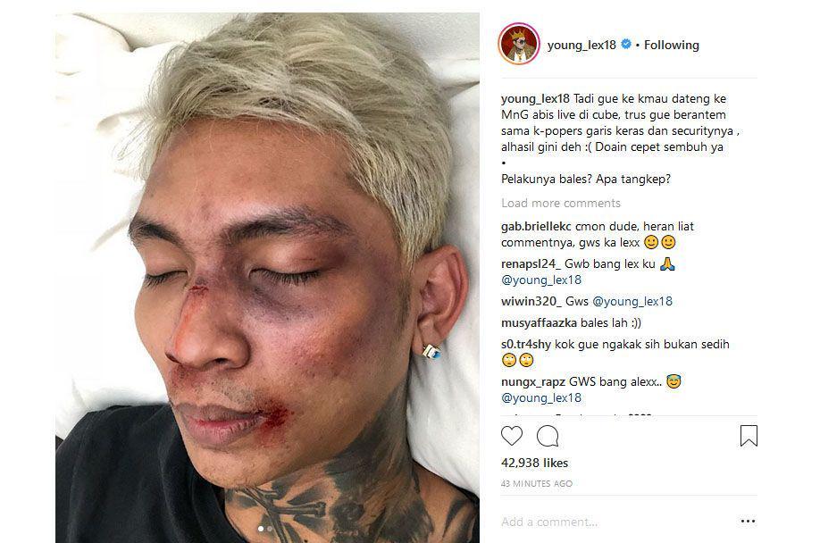 Datangi Event Lisa BLACKPINK, Young Lex Mengaku Dihajar Oknum Fans