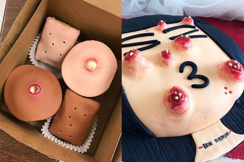 Lihatlah 10 Kue Berbentuk Jerawat Ini, Masih Doyan Makan?
