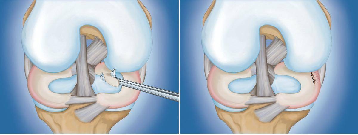 orthoinfo.aaos.org