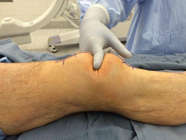 orthoinfo.aaos.org