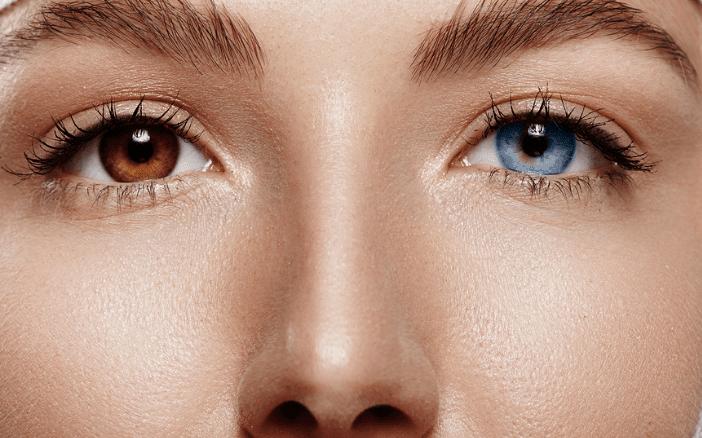 7 Fakta Heterochromia, Orang yang Lahir dengan Warna Mata Berbeda
