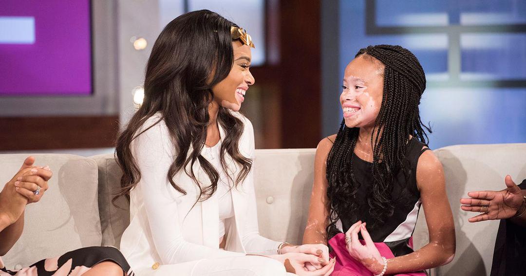 7 Cara Belajar Menerima Diri Sendiri dari Winnie Harlow, Inspiratif!