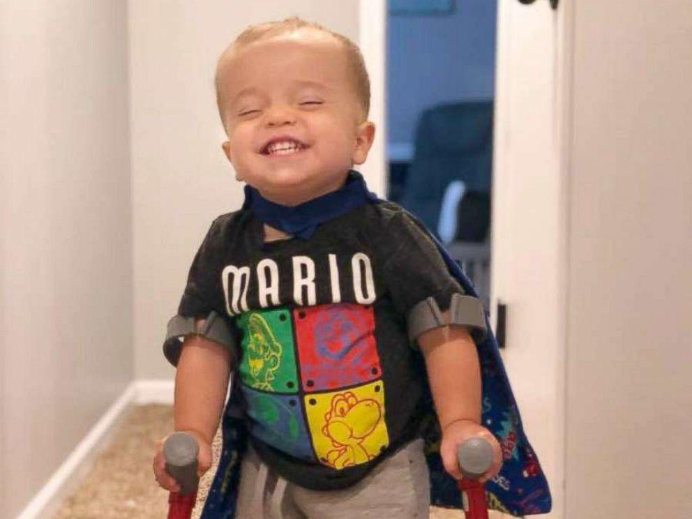 Roman Dinkel, Penderita Spina Bifida yang Menginspirasi Jutaan Orang