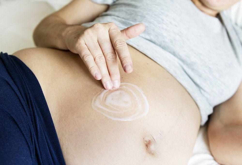 5 Cara Ampuh Hilangkan Bekas Luka dan Stretch Mark, Langsung dari Ahli