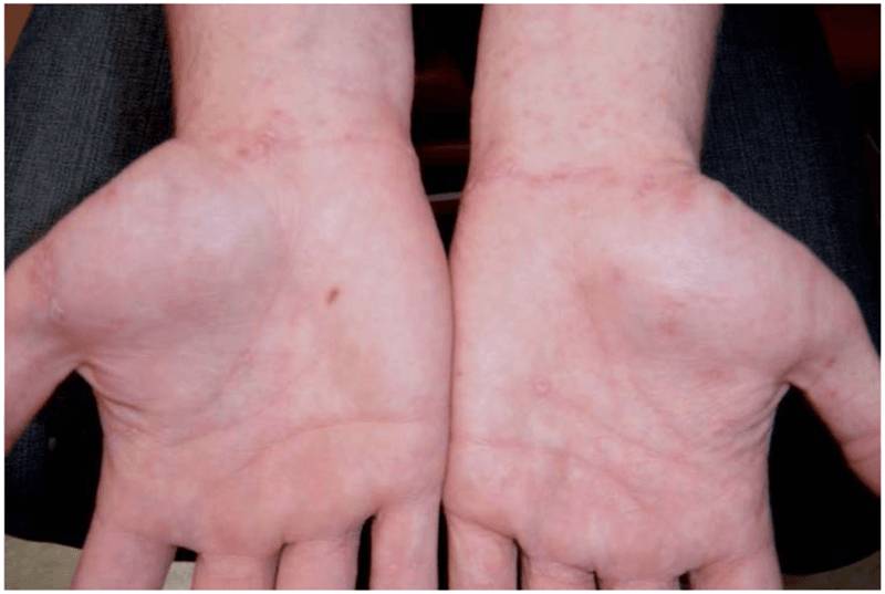 drscabies.com