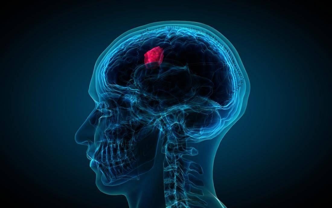 medicalnewstoday.com