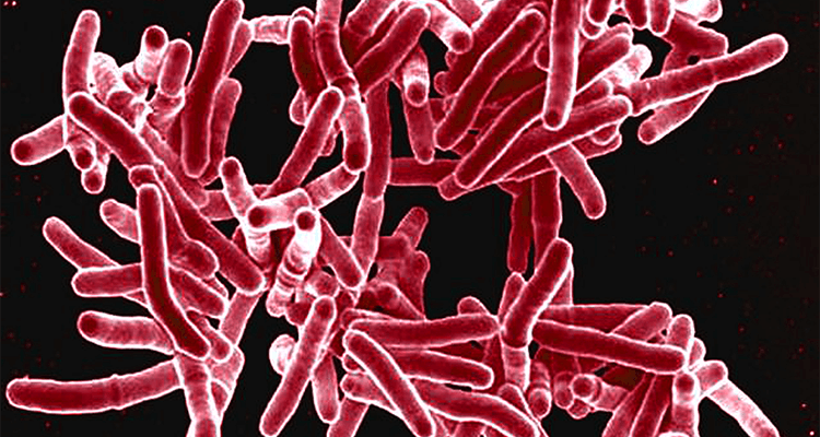 Bakteri Mycobacterium tuberculosis. (hsph.harvard.edu)