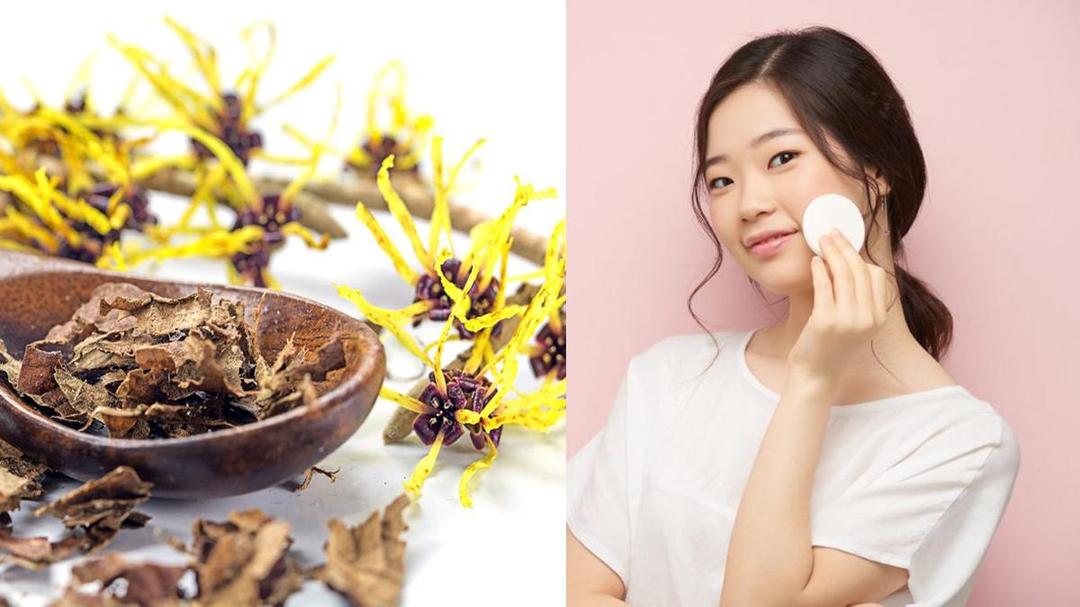 Lebih Ramah dari Alkohol, 5 Manfaat Witch Hazel dalam Produk Skincare