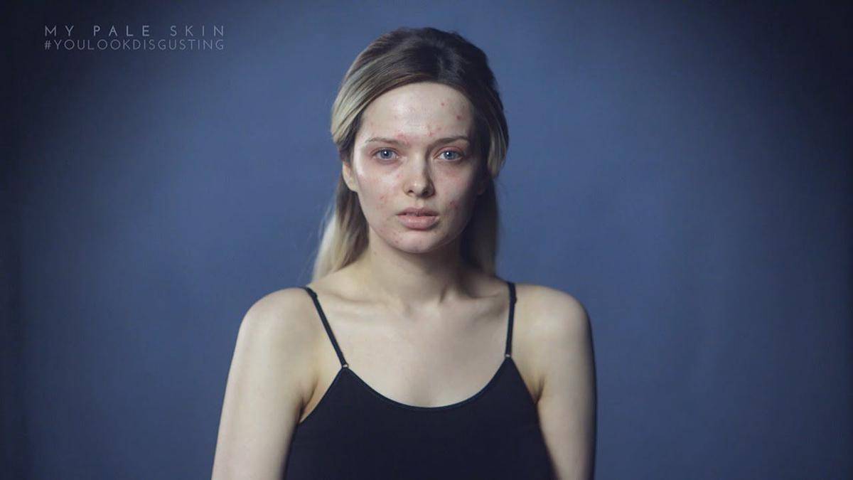 youtube.com/My Pale Skin