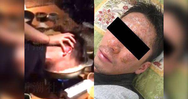 Pria Jepang Gugat Bos Setelah Kepalanya Dicelup ke Kuah Sup Mendidih